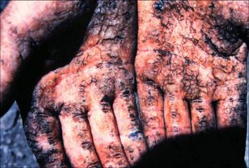 Arsenic 