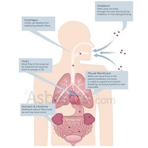 asbestos affects on humans