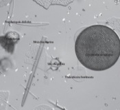 diatoms