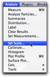 analyse set scale drop down