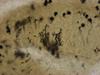 Cerebellum - Golgi stain