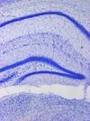 Hippocampus - Nissl stain
