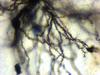 Striatum - Golgi stain