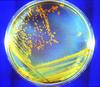 Deinococcus radiodurans on plate media