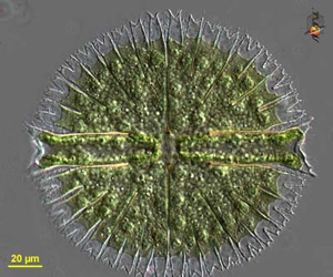 Micrasterium from a slow moving freshwater stream in New South Wales Australia