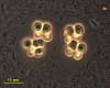 Microcystis