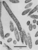 B. infernus photomicrograph