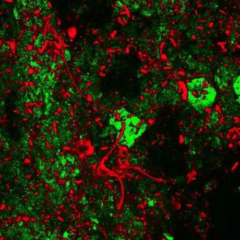 Microbes and minerals fluoresce in different colors using a stain
