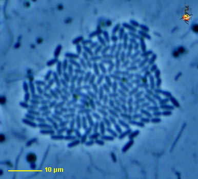 Bacterial Colony