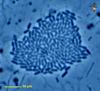 Bacterial Colony