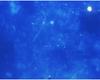 Micrograph of bacteria for front page.