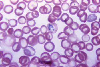 This Giemsa stained micrograph depicts an example of a slightly acidic slide that yielded a pink colored resultant stain.