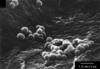 Nanobes found in carbonates by Robert Folk