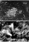 Nanobacteria may also cause cataracts