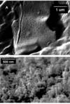 Photo of nanobacteria on teeth