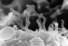 Photo of an alleged nanobacterium.