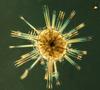 Astrolithium collected from a sediment sample of seawater taken near Woods Hole, MA.