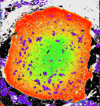 Element map of Mg zoning in garnet.