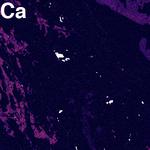 Element map of Ca in a pelitic schist.