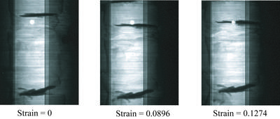 DDIA radiograph