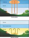 Temperature inversion illustration