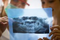 Dental X-ray