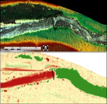 Field Data Collection: Remote Sensing [LiDAR]